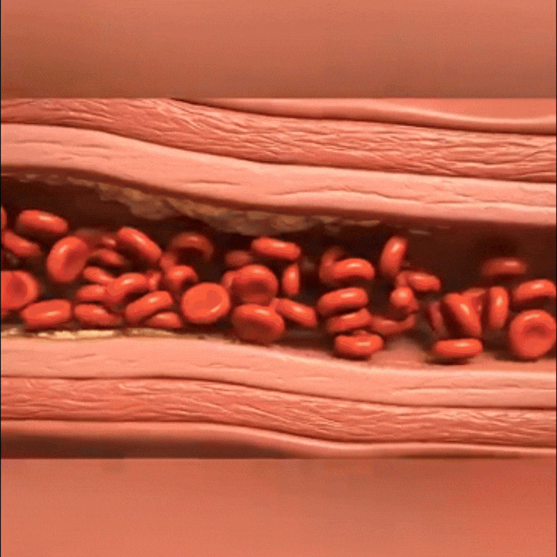 Red Yeast Rice Cholesterol Cleanse image Red Yeast Rice Cholesterol Cleanse